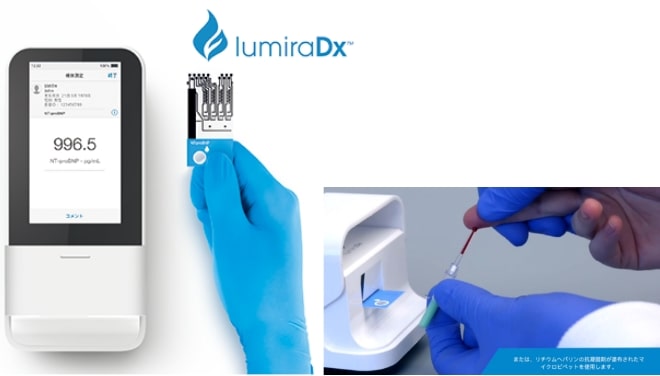 写真：乾式CRP測定機器（ルミラ）